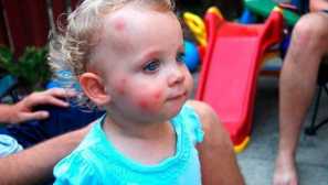 Слепи хапки: как да се разпознават и кои последствия могат да бъдат